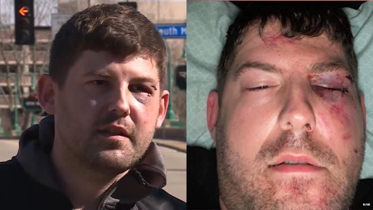 Gay Couple Viciously Beaten Outside Missouri Casino Claim Hate Crime